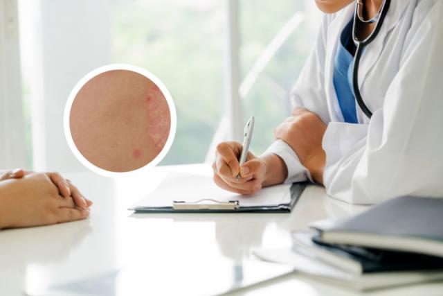 泸州最好的牛皮癣医院